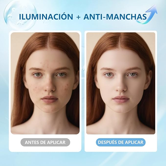 DESPIDETE DE LAS MANCHAS DE TU PIEL  - EN 8 SEMANAS LUCIRAS RADIANTE