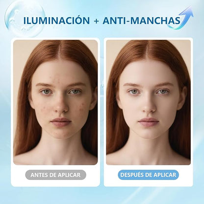 DESPIDETE DE LAS MANCHAS DE TU PIEL  - EN 8 SEMANAS LUCIRAS RADIANTE